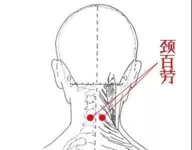 脖子酸、肩颈痛？按按这3处，轻松缓解！(图1)